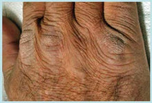 Load image into Gallery viewer, Hylunia - Hyaluronic Reconstructive Creme with Pomegranate 5.1 fl oz