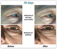 Load image into Gallery viewer, Hylunia Intensive Repair Eye Cream - 0.5 fl oz - Anti-Aging for Dark Circles and Wrinkles - with Vitamin E, Shea Butter, Hyaluronic Acid Serum - Natural Vegan Moisturizer