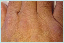 Load image into Gallery viewer, Hylunia - Salicylic Facial Cleanser 6.0 fl oz
