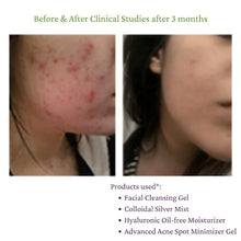 Load image into Gallery viewer, Hylunia Facial Cleansing Gel - 5.1 fl oz - Lavender, Hyaluronic Acid Serum - Acne - Rapid Skin Repair
